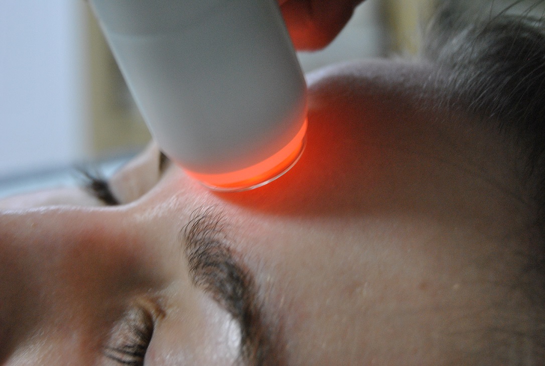 Kundin bekommt eine cold Plasma Behandlung